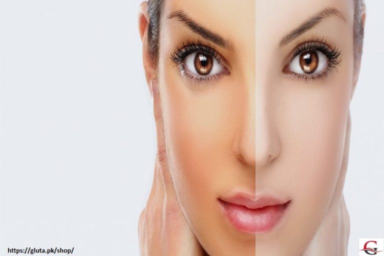 5 Best Face Whitening Cream In Pakistan With Price 2024 Gluta One