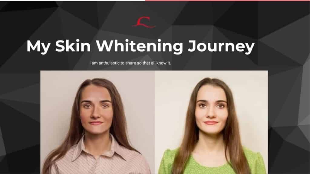 Skin whitening journey before and after