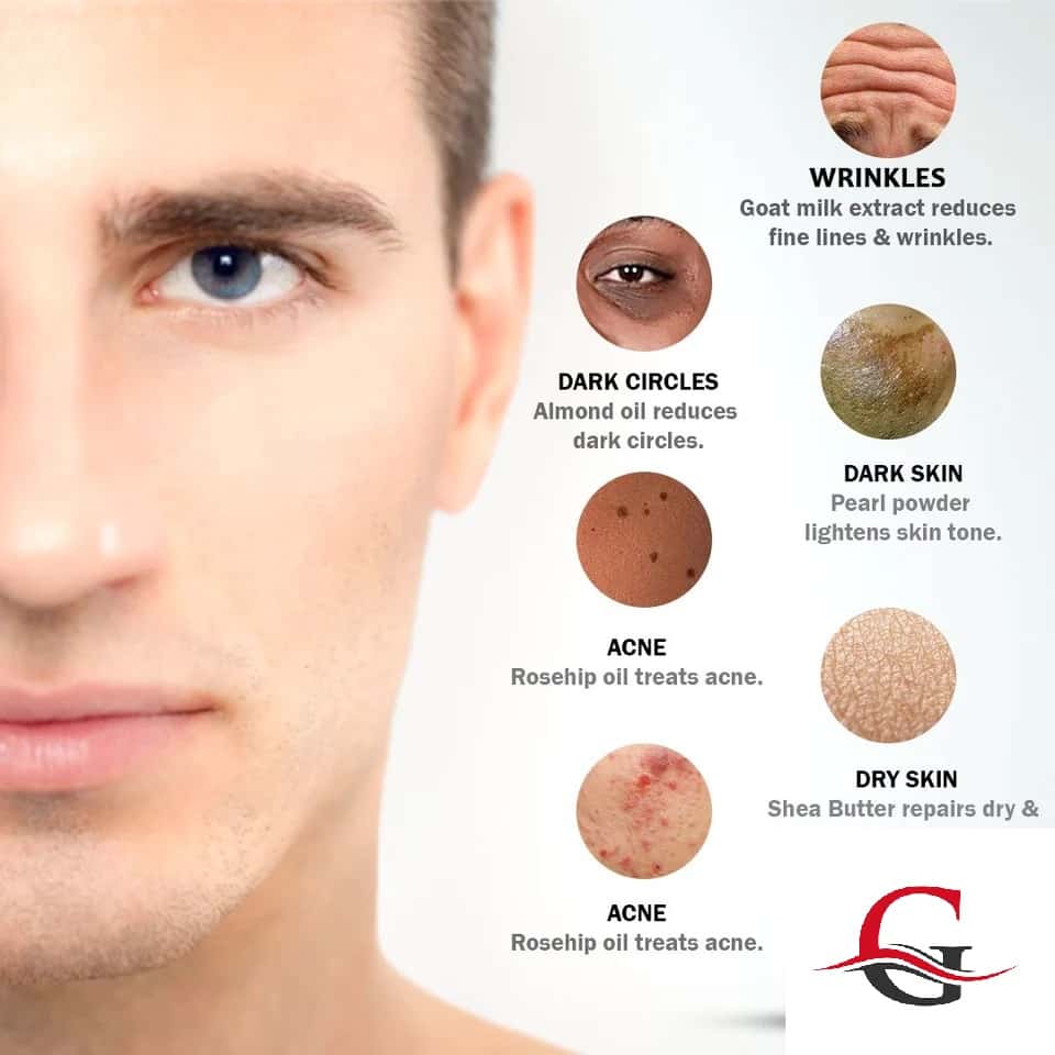 Skin whitening capsules for male