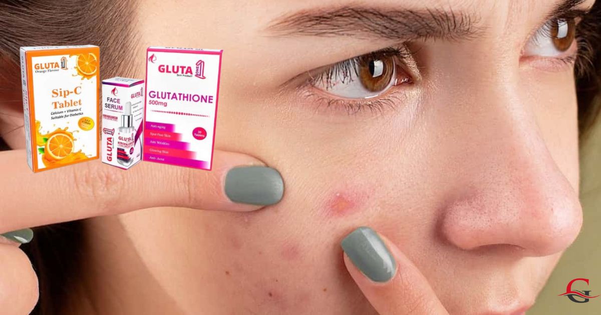 Skin Whitening Capsules for Acne Scars 2024 Gluta One