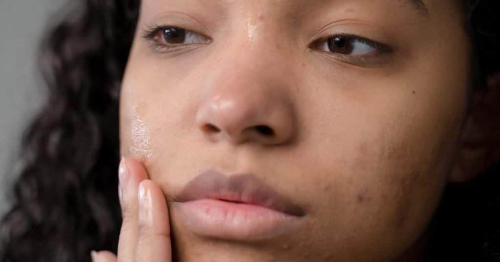 Key Ingredients in Skin Whitening Capsules